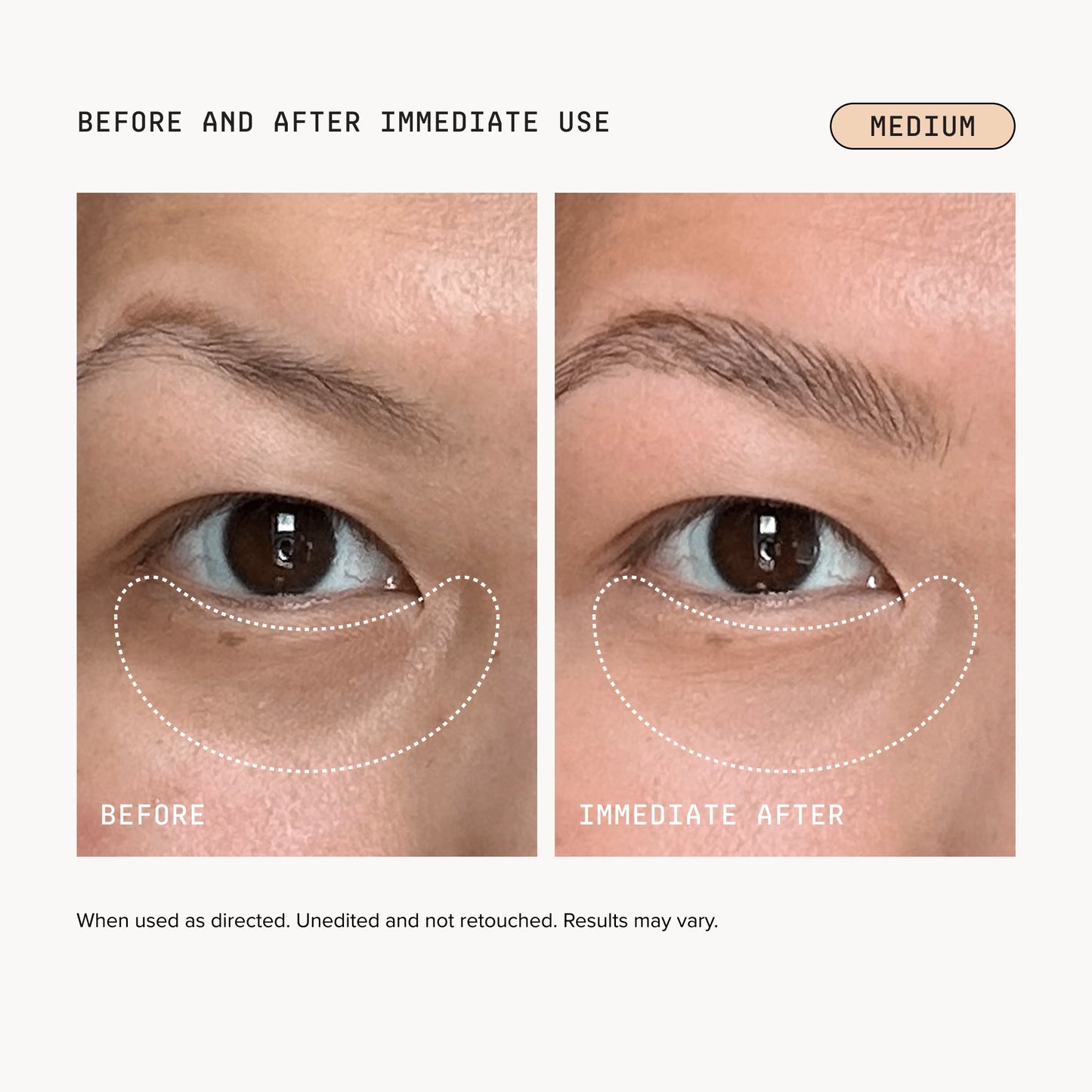 🎉Last Day Buy 1 Get 1 Free|Tidypap Brightening Eye Corrector